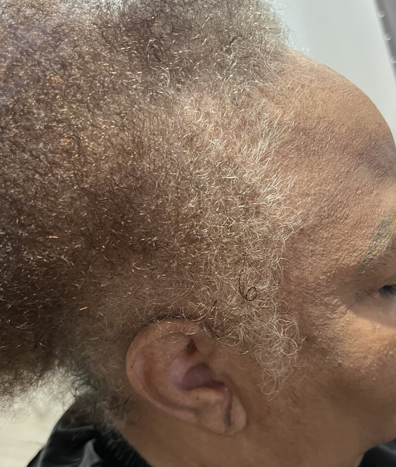 Documented client case, side profile following structured care