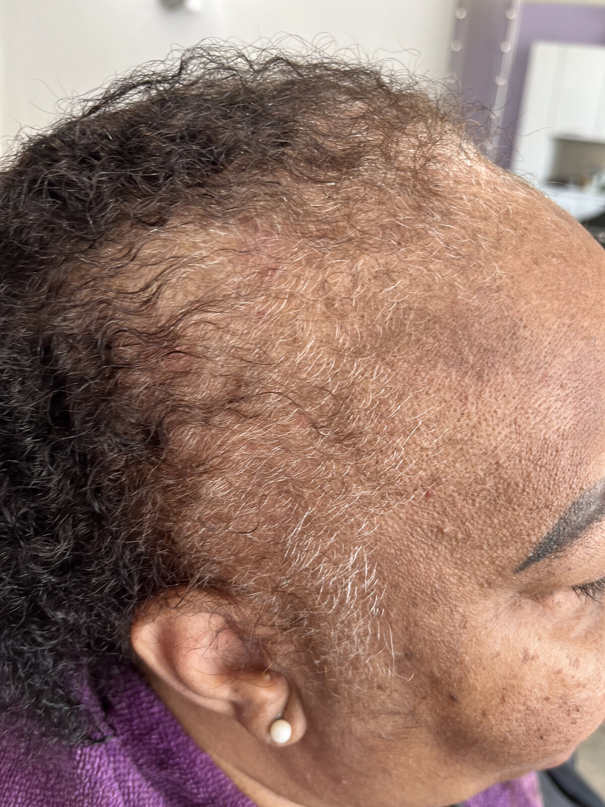 Documented client case, side profile prior to structured care